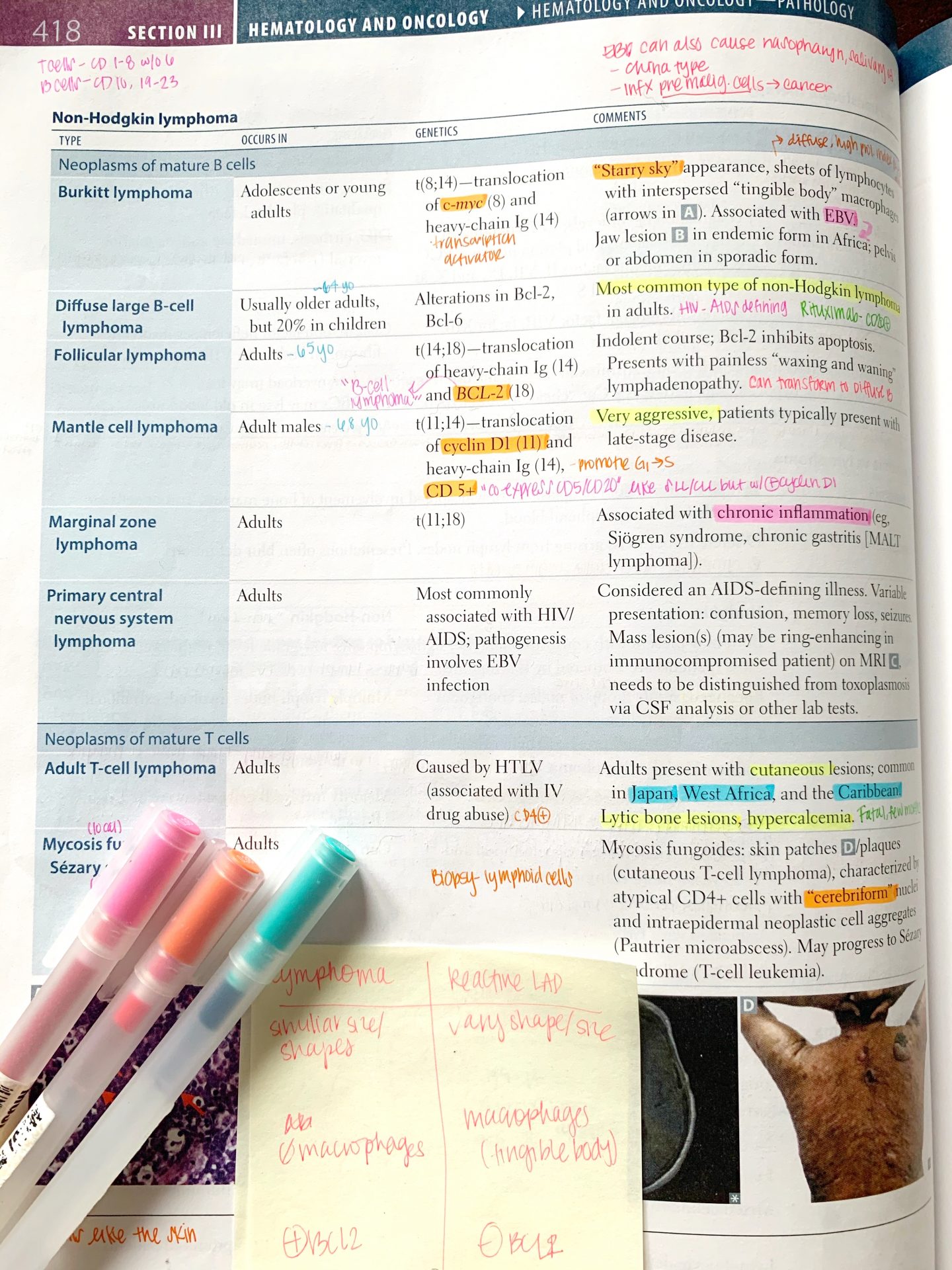 Best Way to Annotate USMLE Step 1 First Aid for Studying – Lily In Medicine